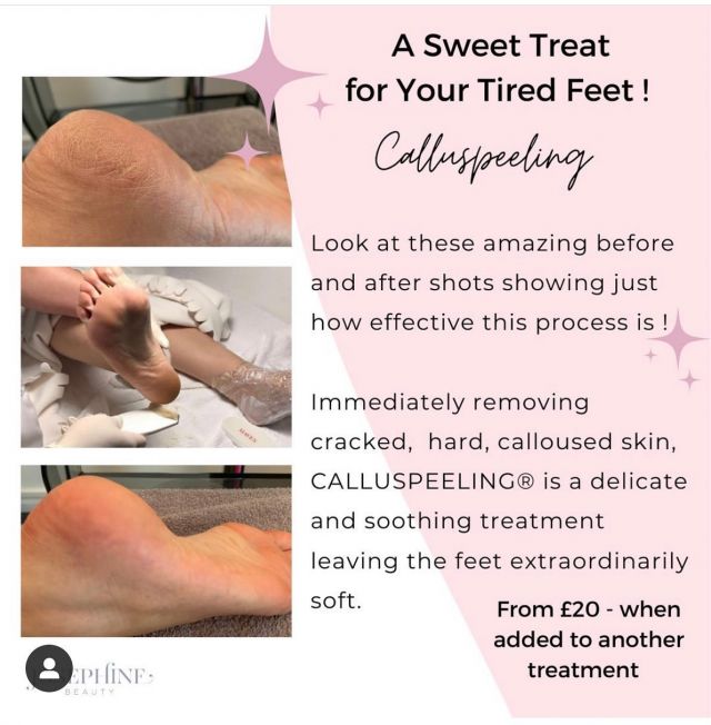 👣Treat your feet to a Mavex Hard skin peel treatment. Mavex will help to soften and smooth your skin so youre ready for sandal weather 🏖